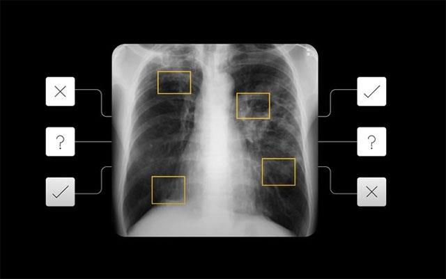 Google ontwikkelt AI-algoritmen die dermatologische ziekten en tuberculose kunnen diagnosticeren